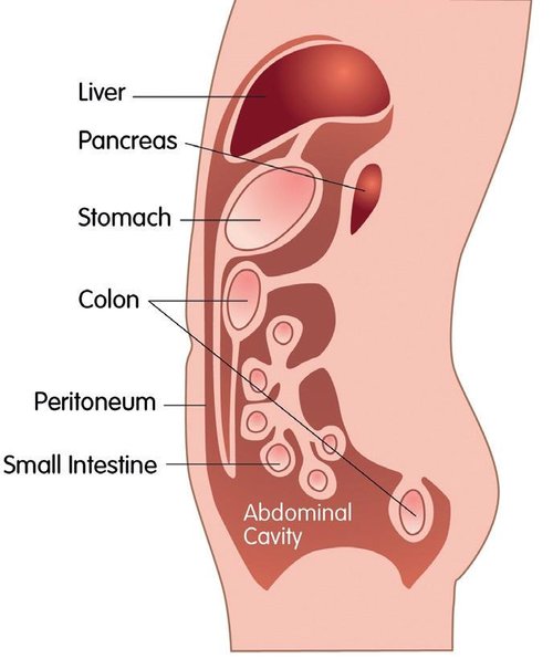 peritoneal 13.03.18.jpg